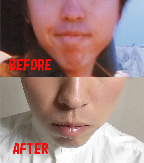 顔痩せドットコム 効果があった顔痩せ方法やダイエット法についての情報を提供しています